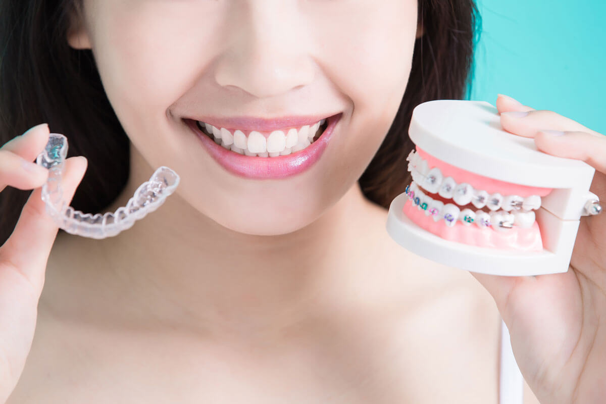 Invisalign Advantages vs Traditional Braces. What's the Better Option? -  Alicia Dental